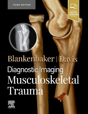 【预订】Diagnostic Imaging: Musculoskeletal Trauma