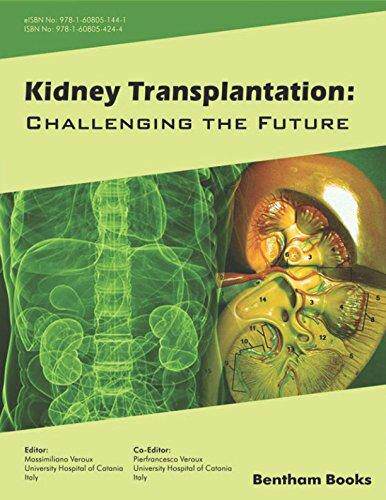 国外库房发货，通常付款后5-8周到货！