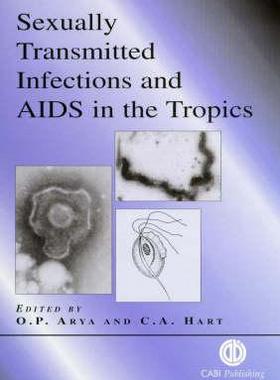 预订 Sexually Transmitted Infections and AIDS in the Tropics
