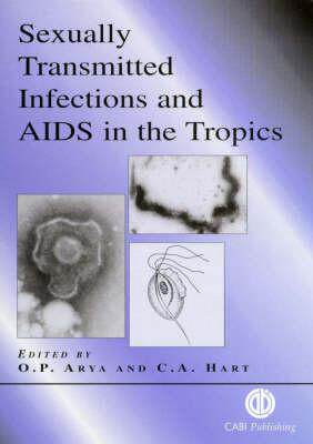 预订 Sexually Transmitted Infections and AIDS in the Tropics
