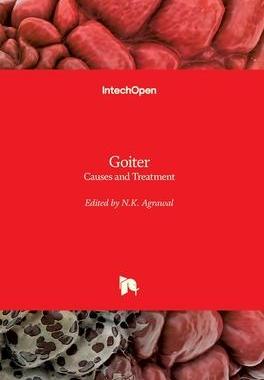[预订]Goiter - Causes and Treatment 9781789859638