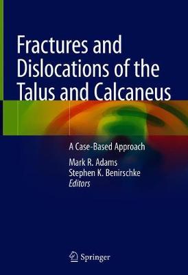【预订】Fractures and Dislocations of the Talus and Calcaneus
