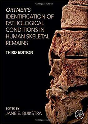 【预售】Identification of Pathological Conditions in Human Skeletal Remains