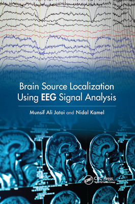 【预订】Brain Source Localization Using Eeg Signal Analysis