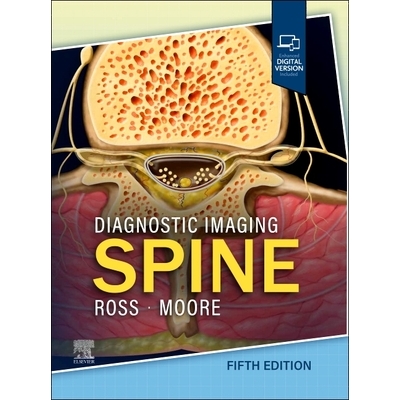 Spine
