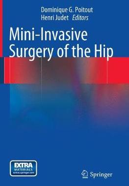 预订 Mini-Invasive Surgery of the Hip