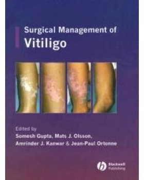 预订 Surgical Management Of Vitiligo 白癜风外科处置: 9781405145213