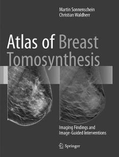 Breast Atlas Tomosynthesis 预订