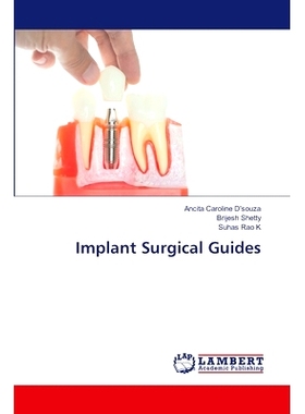 预订 Implant Surgical Guides: 9786208009618