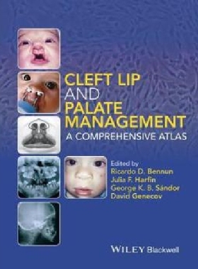 【预订】Cleft Lip And Palate Management