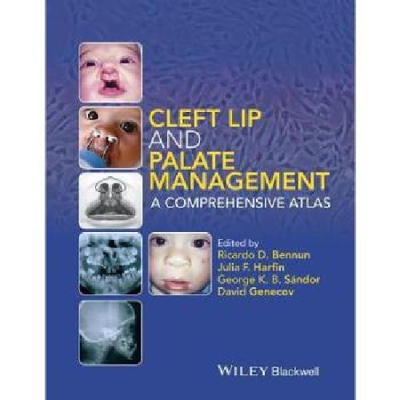 【预订】Cleft Lip And Palate Management
