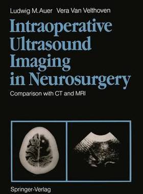 预订 Intraoperative Ultrasound Imaging in Neurosurgery
