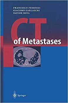 【预订】CT of Metastases
