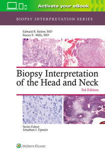 Interpretation the and Biopsy Head Neck 预订