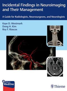 [预订]Incidental Findings in Neuroimaging and Their Management 9781626238282