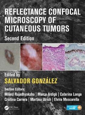 【预订】Reflectance Confocal Microscopy of Cutaneous Tumors, Second Edition