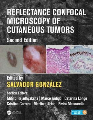【预订】Reflectance Confocal Microscopy of Cutaneous Tumors, Second Edition