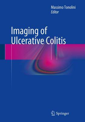 【预订】Imaging of Ulcerative Colitis