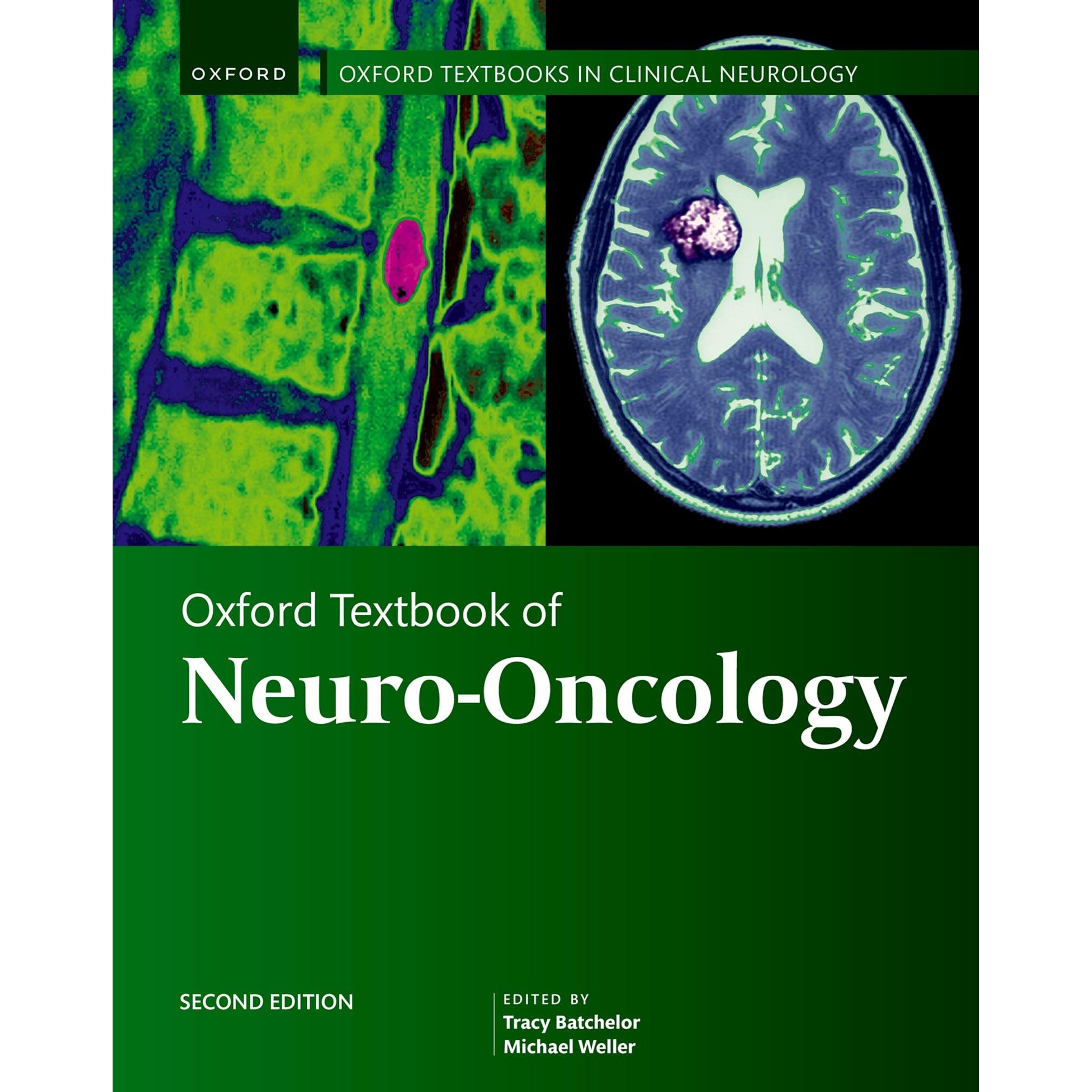 预订 Oxford Textbook of Neuro-Oncology 牛津神经肿瘤学* 9780198869702
