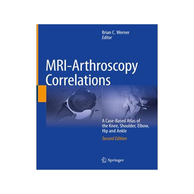 [预订]MRI-Arthroscopy Correlations 9783030947880