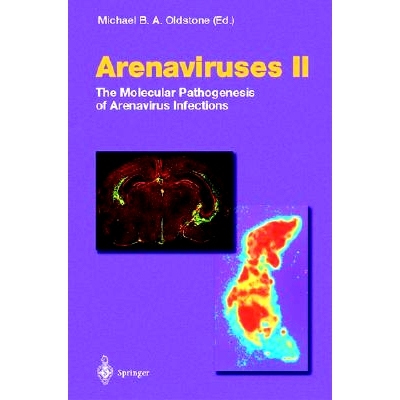 预订 Arenaviruses II: The Molecular Pathogenesis of Arenavirus Infections: 9783540427056