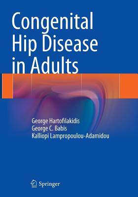 【预订】Congenital Hip Disease in Adults