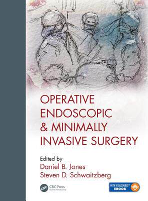 【预订】Operative Endoscopic and Minimally Invasive Surgery