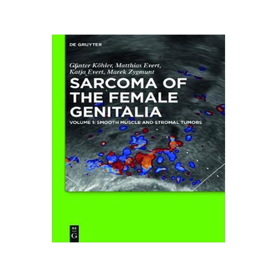 [预订]Smooth muscle and stromal tumors and prevention of inadequate surgery 9783110351415