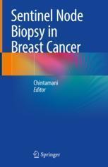 Node Biopsy Cancer Sentinel Breast 9788132239925 预订