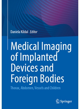 预订 Medical Imaging of Implanted Devices and Foreign Bodies: Thorax, Abdomen, Vessels and Children 植入装置与异物的医学