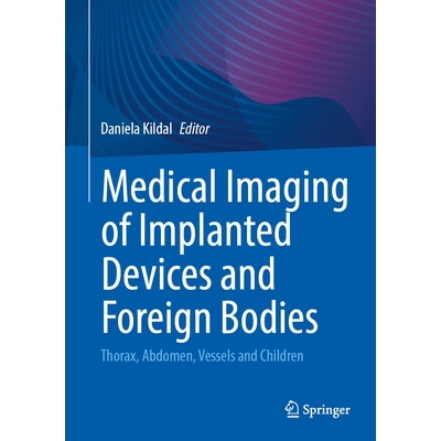 预订 Medical Imaging of Implanted Devices and Foreign Bodies: Thorax, Abdomen, Vessels and Children 植入装置与异物的医学