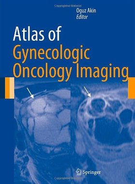 【预订】Atlas of Gynecologic Oncology Imaging