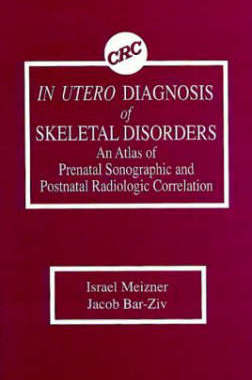 预订 In Utero Diagnosis of Skeletal Disorders An Atlas of Prenatal Sonographic and Postnatal Radiologic Correlation