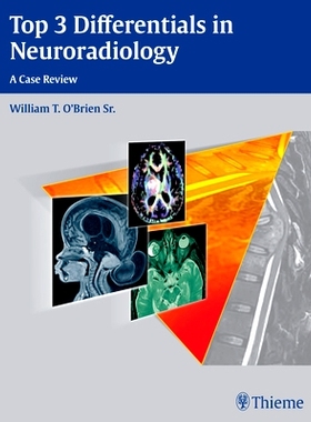 预订 Top 3 Differentials in Neuroradiology 神经放射学3大差距: 9781604067231