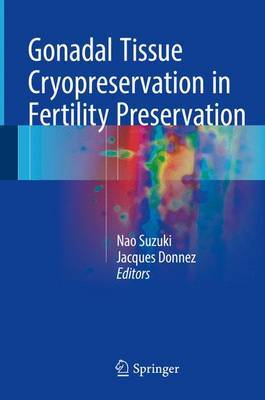 【预订】Gonadal Tissue Cryopreservation in Fertility Preservation