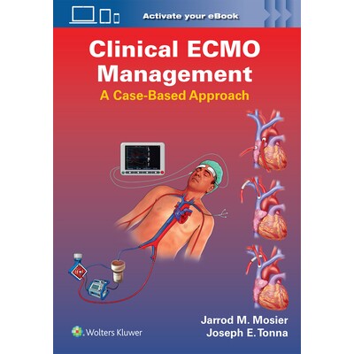 预订 Clinical ECMO Management A Case-Based Approach ECMO临床管理:案例教学法 9781975240141