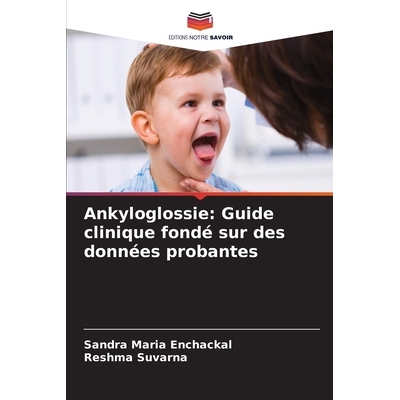 预订 Ankyloglossie: Guide clinique fondé sur des données probantes: 9786209286827