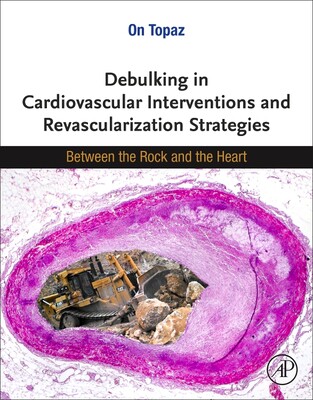 [预订]Debulking in Cardiovascular Interventions and Revascularization Strategies