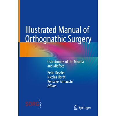 预订 Illustrated Manual of Orthognathic Surgery Osteotomies of the Maxilla and Midface 正颌手术图解手册:上颌骨及中脸截