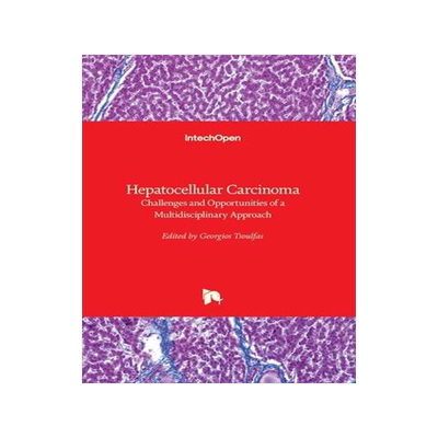 [预订]Hepatocellular Carcinoma - Challenges and Opportunities of a Multidisciplinary Approach 9781839691102