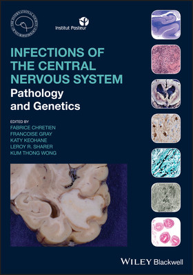 【预订】Infections Of The Central Nervous System - Pathology And Genetics