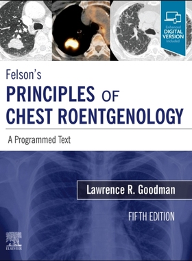 【预订】Felson’s Principles of Chest Roentgenology, a Programmed Text