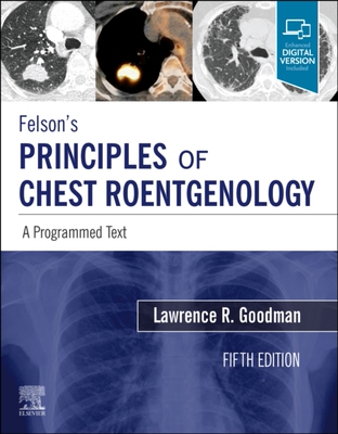 【预订】Felson’s Principles of Chest Roentgenology, a Programmed Text