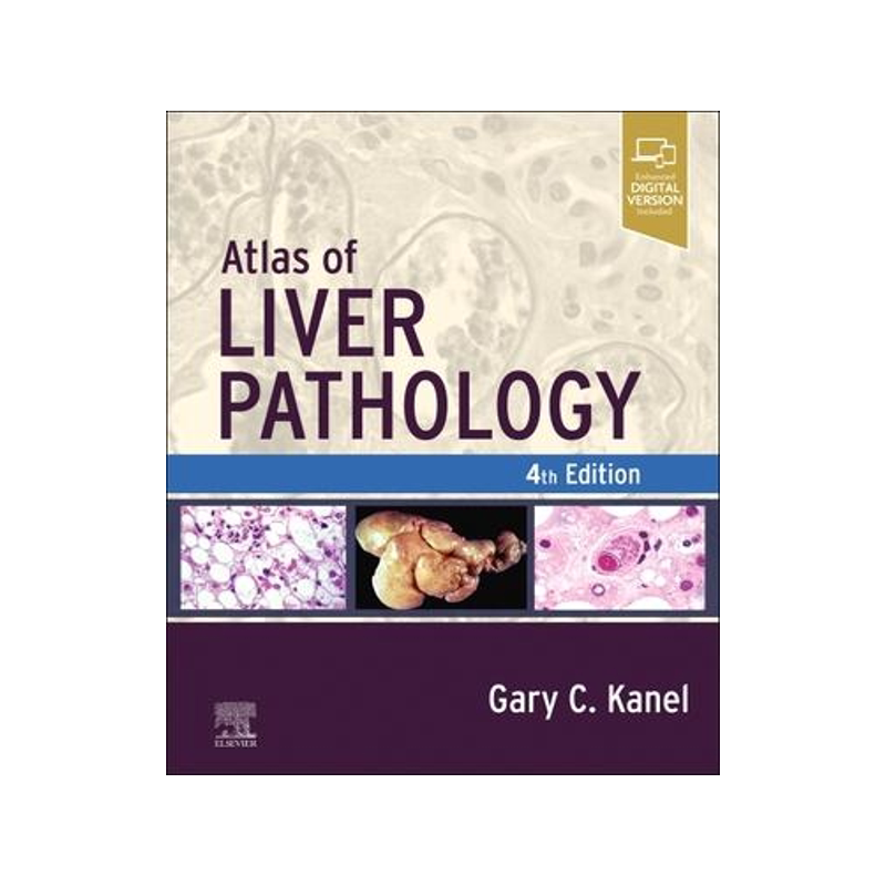 [预订]Atlas of Liver Pathology 9780323825337