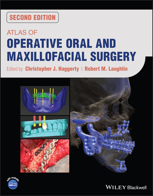 [预订]Atlas Of Operative Oral And Maxillofacial Surgery