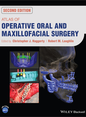 [预订]Atlas Of Operative Oral And Maxillofacial Surgery