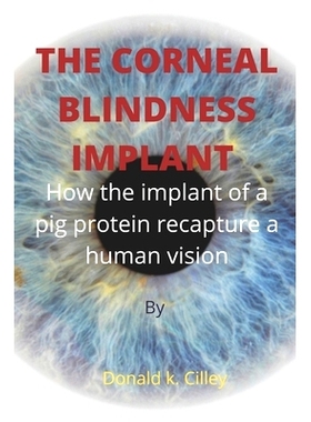 预订 The Corneal Blindness Implant: How the implant of a pig protein recapture a human vision: 9798846819634