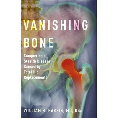 预订 Vanishing Bone Conquering a Stealth Disease Caused by Total Hip Replacements 消失的骨头：征服全髋关节置换引起的隐形
