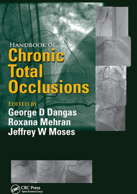 【预订】Handbook of Chronic Total Occlusions