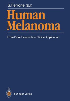 【预订】Human Melanoma